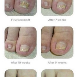 Samenwerkende Pedicures Kalknagels 75ml Samenwerkende Pedicures Kalknagels 75ml