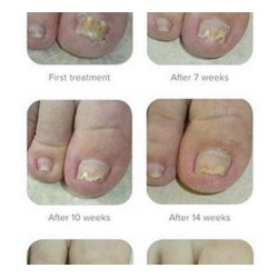 Samenwerkende Pedicures Kalknagels 75ml Samenwerkende Pedicures Kalknagels 75ml